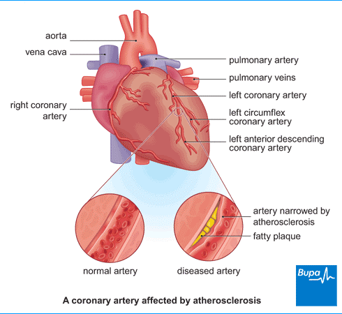 Acana causing heart sales disease